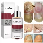 LANBENA Nail Repair Essence - 15ml - Image 2